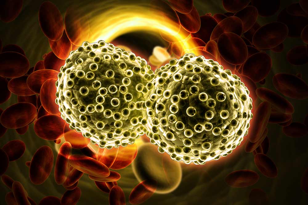 A close up view of an artist rendered lung cancer cell.